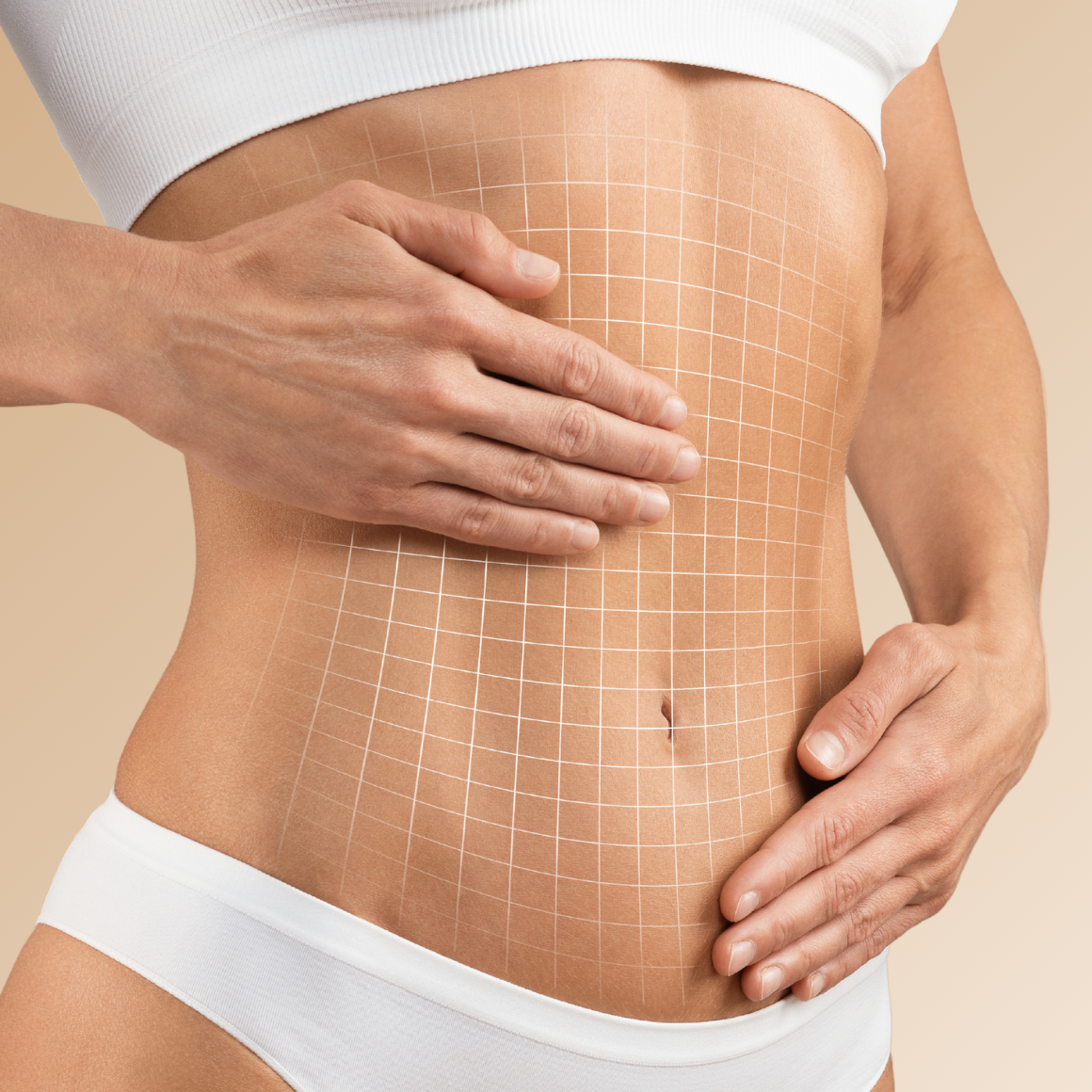 Hautstraffung - Behandlungsbereiche Bauch